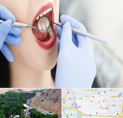 جراح دندان عقل در کن