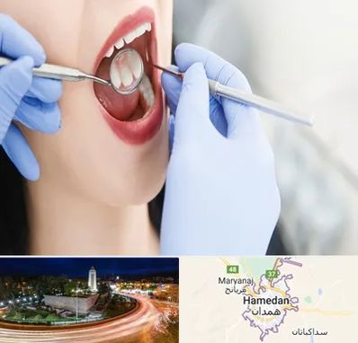 جراح دندان عقل در همدان