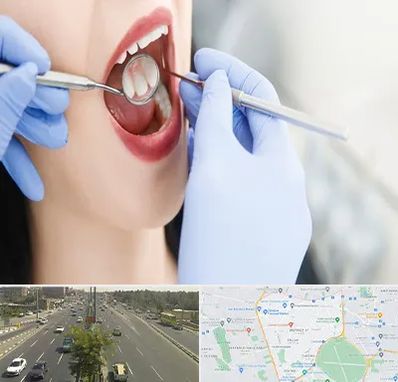 جراح دندان عقل در منطقه 17 تهران