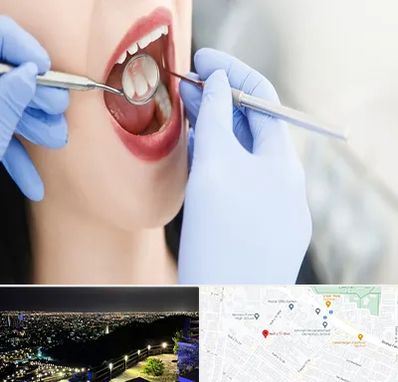جراح دندان عقل در هفت تیر مشهد