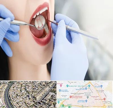 جراح دندان عقل در شهرک غرب مشهد