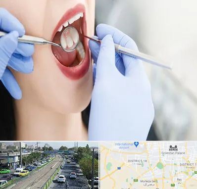 جراح دندان عقل در جنوب تهران 