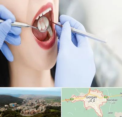 جراح دندان عقل در گرگان