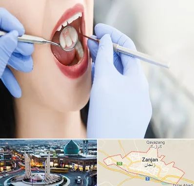 جراح دندان عقل در زنجان