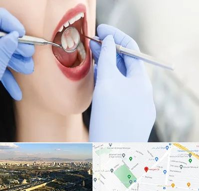 جراح دندان عقل در هنگام
