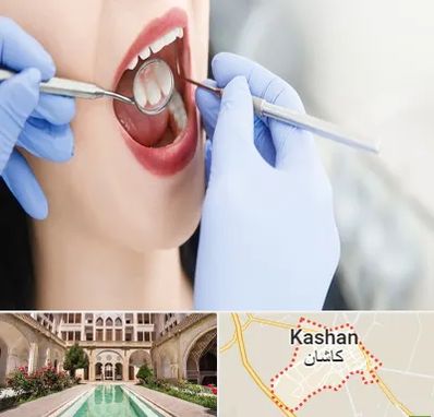 جراح دندان عقل در کاشان