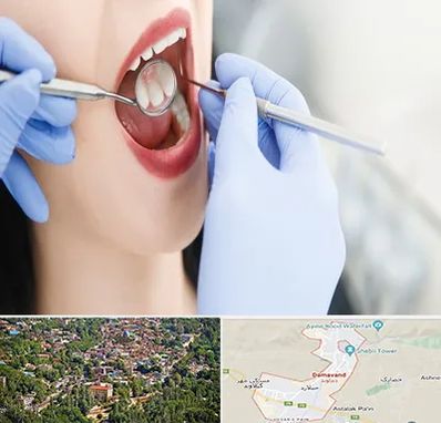 جراح دندان عقل در دماوند