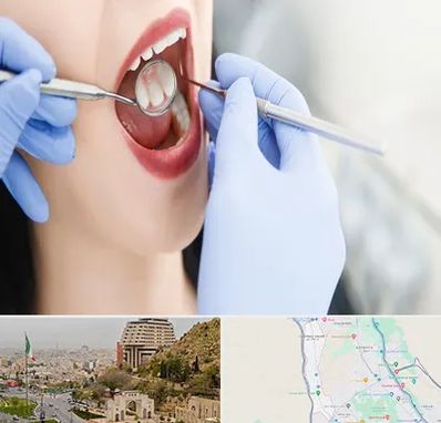 جراح دندان عقل در فرهنگ شهر شیراز