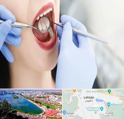 جراح دندان عقل در لاهیجان