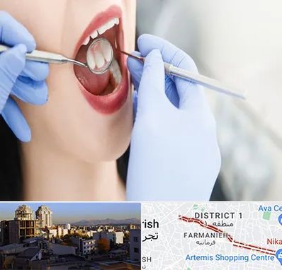 جراح دندان عقل در فرمانیه 