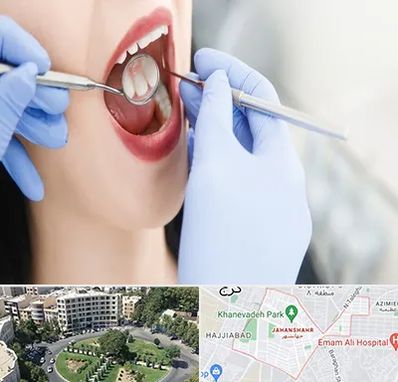 جراح دندان عقل در جهانشهر کرج 