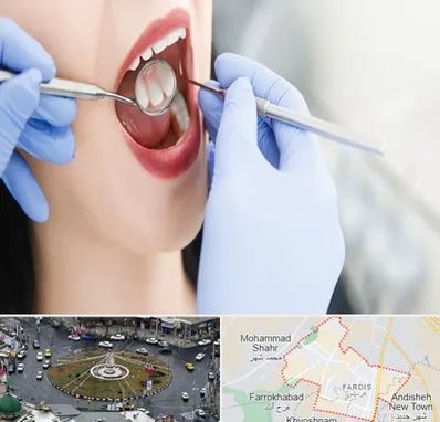 جراح دندان عقل در فردیس کرج 