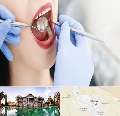 جراح دندان عقل در شیراز