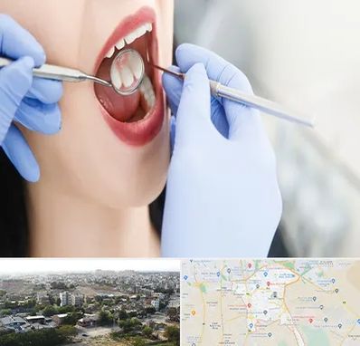 جراح دندان عقل در منطقه 20 تهران