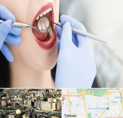 جراح دندان عقل در مرزداران 