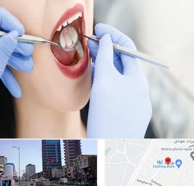 جراح دندان عقل در چهارراه طالقانی کرج