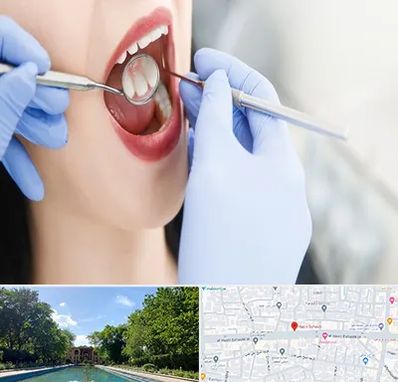 جراح دندان عقل در هشت بهشت اصفهان