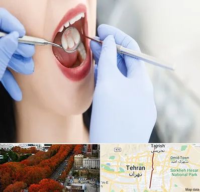 جراح دندان عقل در ولیعصر 
