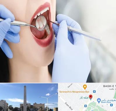 جراح دندان عقل در فلکه گاز شیراز