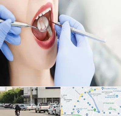 جراح دندان عقل در قدوسی شرقی شیراز