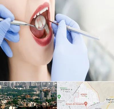 جراح دندان عقل در عظیمیه کرج 