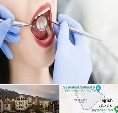 جراح دندان عقل در زعفرانیه 