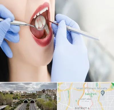 جراح دندان عقل در یوسف آباد 