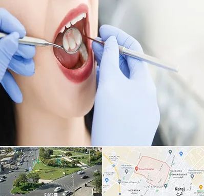 جراح دندان عقل در شاهین ویلا کرج