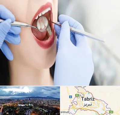 جراح دندان عقل در تبریز