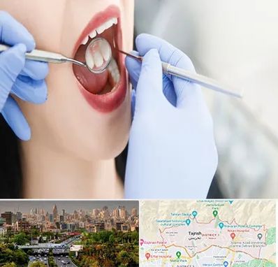 جراح دندان عقل در منطقه 1 تهران