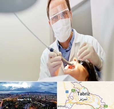 جراح لثه در تبریز