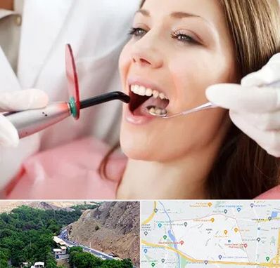 متخصص درمان ریشه دندان در کن