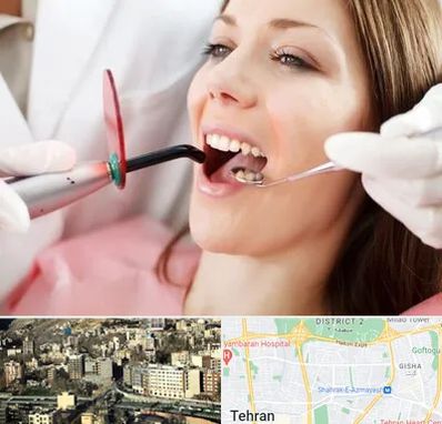 متخصص درمان ریشه دندان در مرزداران 