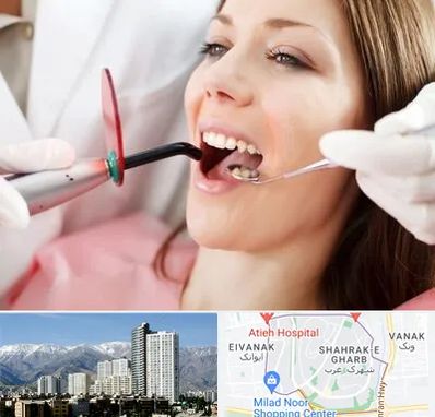 متخصص درمان ریشه دندان در شهرک غرب 