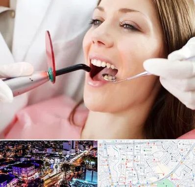 متخصص درمان ریشه دندان در منظریه رشت