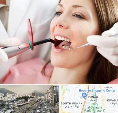 متخصص درمان ریشه دندان در پونک 