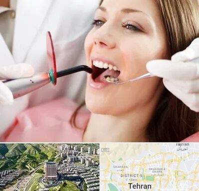 متخصص درمان ریشه دندان در شمال تهران 