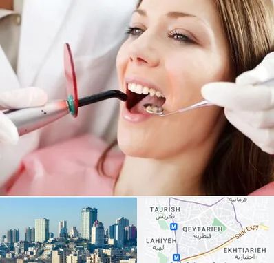 متخصص درمان ریشه دندان در قیطریه 