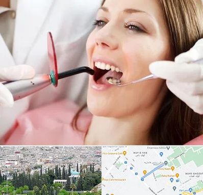 متخصص درمان ریشه دندان در محلاتی شیراز