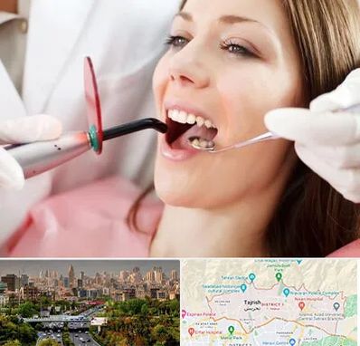متخصص درمان ریشه دندان در منطقه 1 تهران