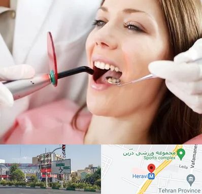 متخصص درمان ریشه دندان در هروی 