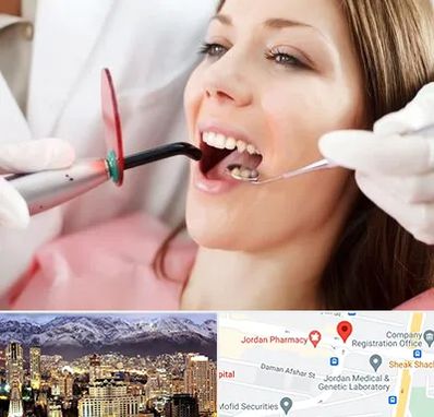 متخصص درمان ریشه دندان در جردن 
