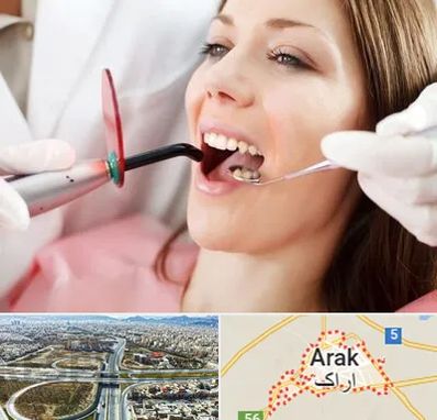 متخصص درمان ریشه دندان در اراک
