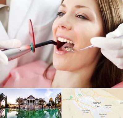 متخصص درمان ریشه دندان در شیراز
