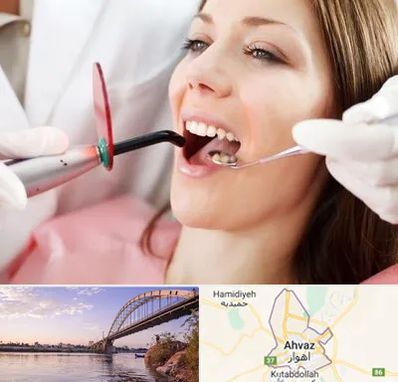متخصص درمان ریشه دندان در اهواز