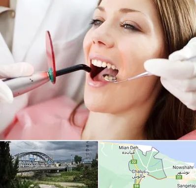 متخصص درمان ریشه دندان در چالوس