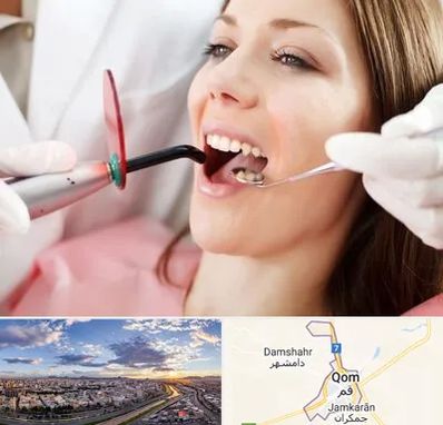 متخصص درمان ریشه دندان در قم