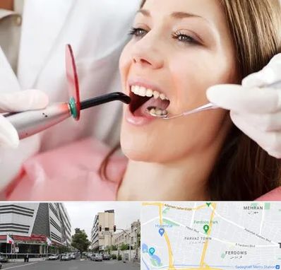 متخصص درمان ریشه دندان در بلوار فردوس 
