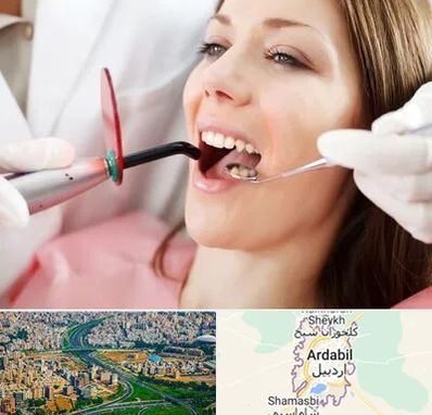 متخصص درمان ریشه دندان در اردبیل