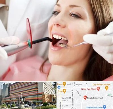 متخصص درمان ریشه دندان در سهروردی 